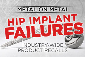 Cariati Law Toronto, Ontario Injury Lawyers Defective Products Metal on Metal Hip Implant Failures Product Recalls