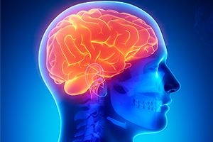 Cariati Law Toronto, Ontario Injury Lawyers Traumatic Brain Injury Lawyers Brain Image