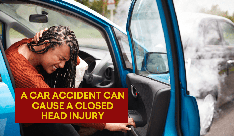 A car accident in Toronto can cause a serious head injury.